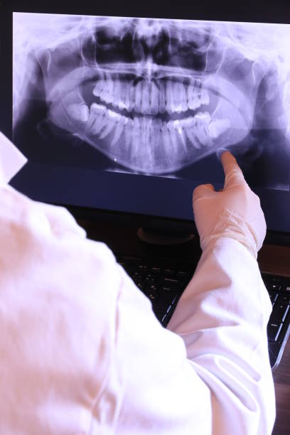 Best Emergency Treatment for Dental Infections or Abscesses in Overlea, MD
